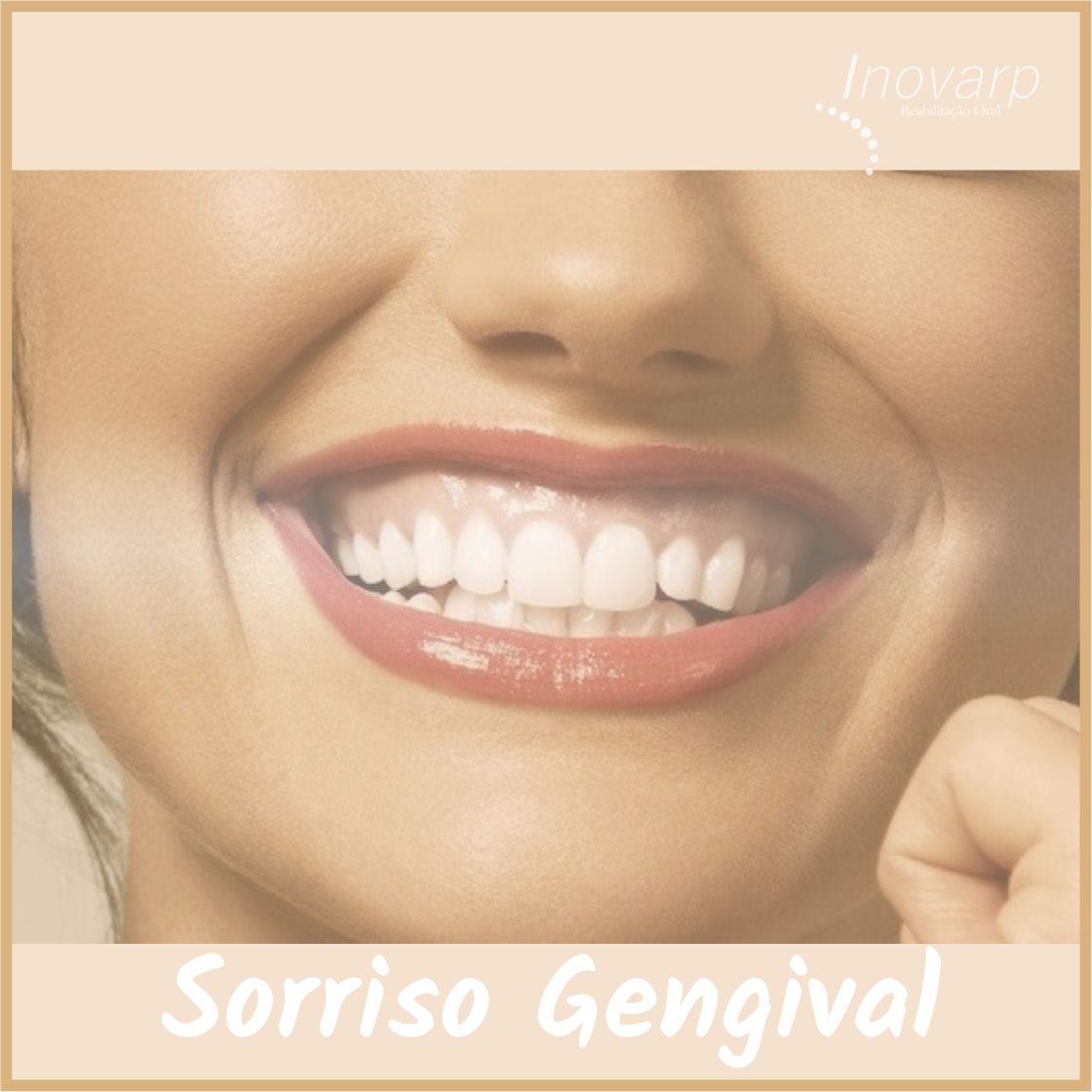 Sorriso Gengival Inovarp Dra Claudia Bustamante E Dr Paulo Melo